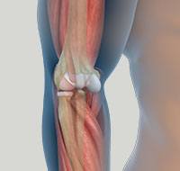 Elbow Injuries